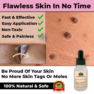NEW SAFE SKIN TAG REMOVER OIL MOLE WART ACNE LIQUID PIMPLE PATCH REMOVAL SPOT - Picture 1 of 5