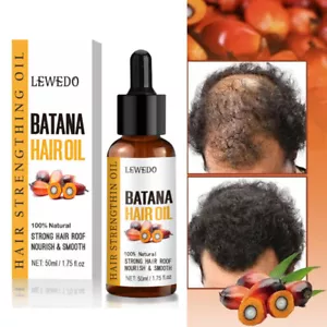 BATANA OIL Serum 120g Hair Growth Pure & Natural - Promotes Hair Regrowth Unisex - Picture 1 of 16