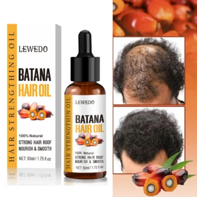 LEWEDO BATANA OIL Serum 50ml Hair Growth Pure & Natural - Promotes Hair Regrowth Unisex