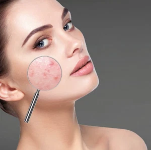 Clear Skin HAUTRETTER- Premium SET von CNC Aesthetic Pharm - Bild 1 von 3