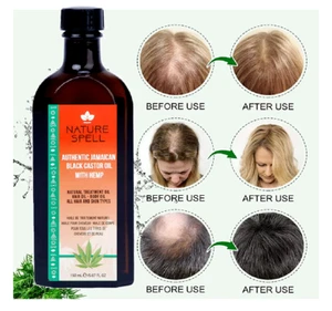 Aceite de hechizo natural para el crecimiento del cabello, pérdida de cabello y piel - CASTOR JAMAICANO & H E M P - Imagen 1 de 11