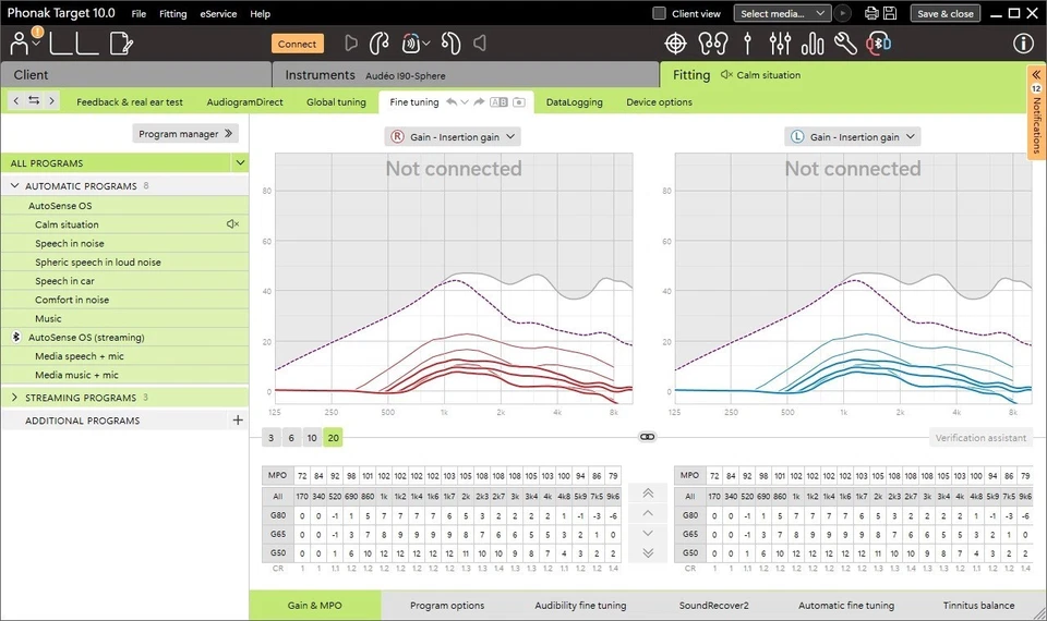 Phonak Target 11 Latest Software Programmer For Hearing Aid 2025 - Image 1 of 1