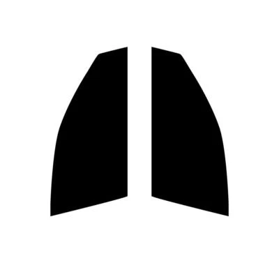 Pre Cut Car Window Tint for Mitsubishi Lancer Evo VIII 2005-08 Front Windows - Image 1 of 4