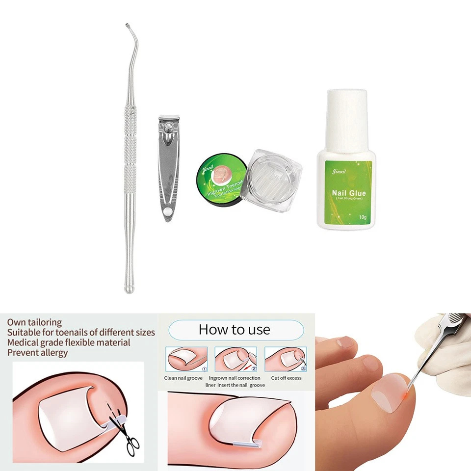 Outils Professionnels D'ongle Incarné Nail Cleaner Patch Pedicure - Photo 1/1