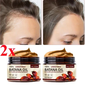 2xBatana Oil Conditioner For Hair Growth Healthier Thicker Fuller Anti Hair Loss - Picture 1 of 14