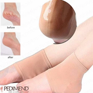 Pedimend Moisturizing Silicone Gel Heel Socks for Dry Hard Cracked Skin (2 PC) - Picture 1 of 7