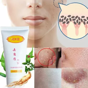 30g Peeling Facial Scrub Cream Gel Exfoliating Whitening Dead Skin Remover -- - Picture 1 of 12