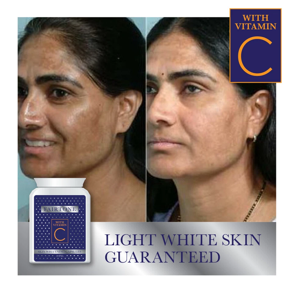 FAIRTONE SKIN WHITENING CAPSULES WITH VITAMIN C MELASMA HYPERPIGMENTATION