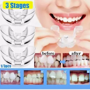 Corrector de dientes de ortodoncia dental de 3 etapas Frenos Herramienta de retención de enderezamiento de dientes - Imagen 1 de 7