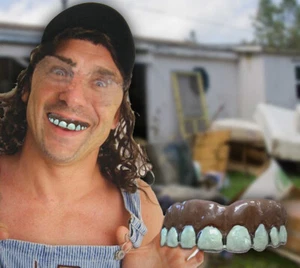 Billy Bobs authentische Original Hillbilly Zähne mit passendem Material - Bild 1 von 2