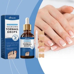 Ingrown Toenail Treatment Drop - Ingrown Toenail Treatment - Cuticle Care Oils - Picture 1 of 13