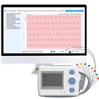 12-Lead Holter Monitor 24 Hours Ecg Ekg Monitor With Ai Analysis Detects Afib