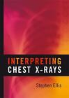 Interpreting Chest X-Rays by Stephen Ellis (English) Paperback Book