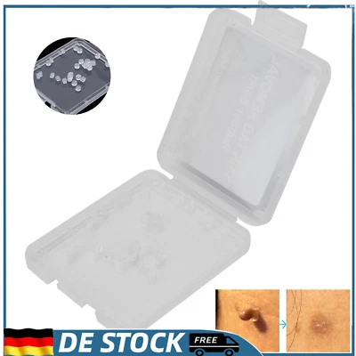 MARKENLOS Extra Kleine Skin Tag Removal Bands 30pcs Micro Skin Tag Removal Gummibände BHC