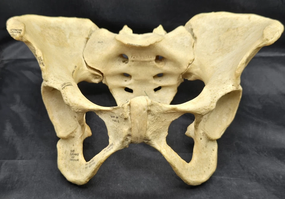 Pelvis adulta hembra con demostrador de paciente L4 y L5 de Sawbones completamente etiquetado Foto 1 de 4