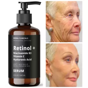 8oz - Retinol, Niacinamide, Vitamin C, Hyaluronic Acid, AntiAging Wrinkle SERUM - Picture 1 of 5