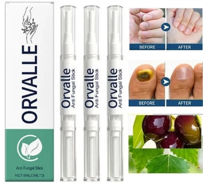 3PCS Orville Nail Fungus Pen Anti Fungus Infection Nail Care Repair Pen Toenail-