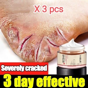 3 x  Horse Oils Foot Care Cream 50g Crack Heal Cream Foot Mask Remove Dead Skin - Picture 1 of 9