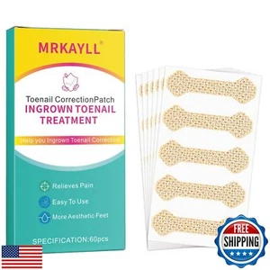 Ingrown Toenail Treatment, 60Pcs Breathable Ingrown Toenail Strips, Professio - Picture 1 of 5
