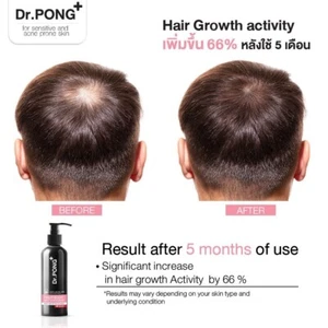 CHAMPÚ SUAVE PARA LA PÉRDIDA DEL CABELLO Dr.PONG TSUTSUJI - Imagen 1 de 5