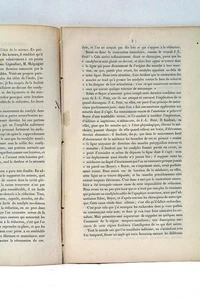 Mémoire procédé de Nélaton réductions luxations de la mâchoire inférieure 1850 - Picture 1 of 7