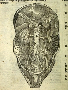 Médecine Gravure tirée de PARÉ Ambroise ANATOMIE DU CORPS HUMAIN, ARTERE RÉNALE - Imagen 1 de 3