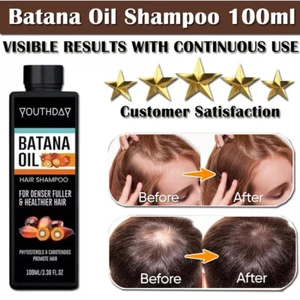 Batana Oil Hair Growth Shampoo: Natural Hair Loss Shampoo for Thinning Hair - Picture 1 of 8