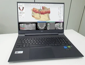 Dental CAD/CAM software Laptop full edition (3shape,inlab etc..) - Picture 1 of 1