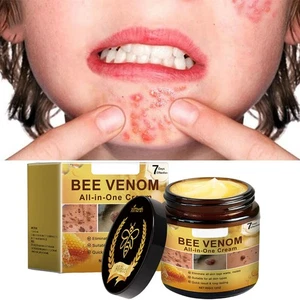 Bee Venom Skin Restoration Cream, Professional Bee Venom Skin Treatment Cream US - Picture 1 of 13