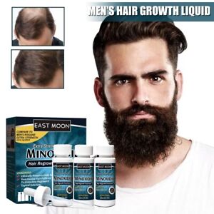 3 stk Minoxidil 5 % extra starke Haarwachstum flüssige Behandlung Lösung Herren