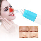 Electric Pore Cleaner Facial Skin Cleansing Acne Removing Blackhead Absorb HEE