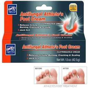 Antifungal Athlete's Foot Cream Treatment Jock Itch Ringworm Itching Anti Fungus - Picture 1 of 1