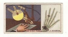 BAT Do You Know #49. An X-Ray tube