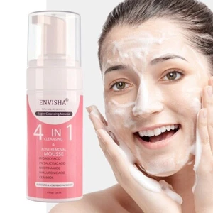 4in1 Facial Skin Care Exfoliating Mousse Peeling Gel Deep Cleaning Acne Removal - Picture 1 of 12