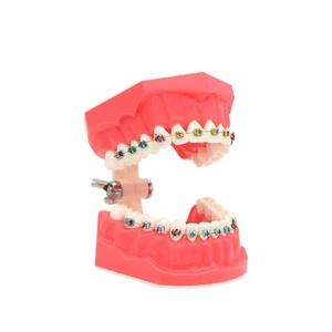 US Dental Typodont Orthodontic Teeth Practice Model with Metal Brackets M7010-2 - Picture 1 of 12