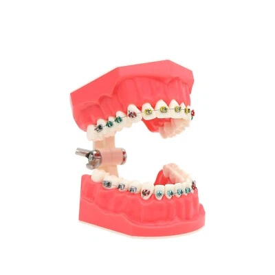 US Dental Typodont Orthodontic Teeth Practice Model with Metal Brackets M7010-2 - Image 1 of 4