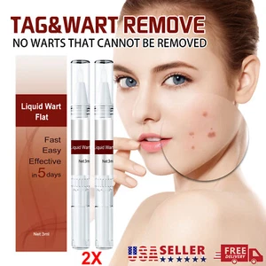 2X Common and Plantar Moles-Off Wartsoff Entferner, Abwischen Etiketten & Moles Entferner USA - Bild 1 von 16