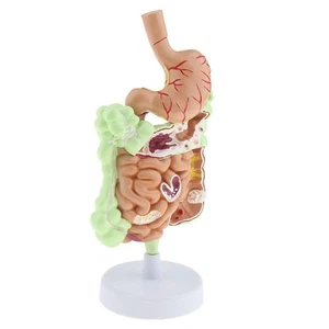 Human Stomach Gastrointestinal Digestive System Model - Picture 1 of 4