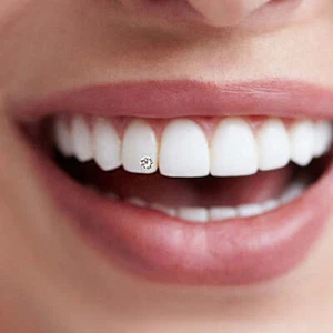 Swarovpro Crystal Tooth Gems (24pcs) - Picture 1 of 11