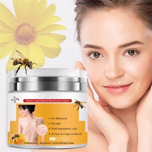 Skin Warts And Flat Warts Cream Skin Warts And Moles Corns Wart Removal Cream - Picture 1 of 8
