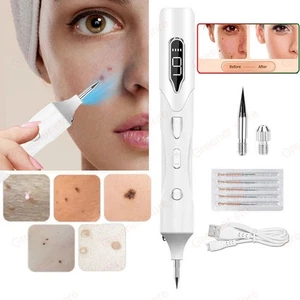 USB LCD Láser Lápiz Lunar Etiqueta de Piel Pecas Removedor de Verrugas Tatuaje Punto Borrador Kit suma - Imagen 1 de 15