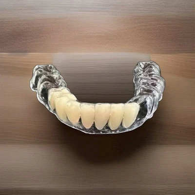 Retainer With Teeth, Affordable Way To Fill In Your Smile, with 1-5 Teeth added. - Image 1 of 4