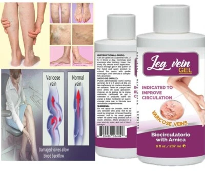 leg Vein Cream Varicose Veins Cream SUPPORT 8 FL OZ blood vein veins support  - Image 1 of 3