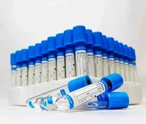 Tubo Citrato Sodio Sottovuoto 2,7 Ml 100 TUBI Con Spedizione Gratuita - Foto 1 di 6