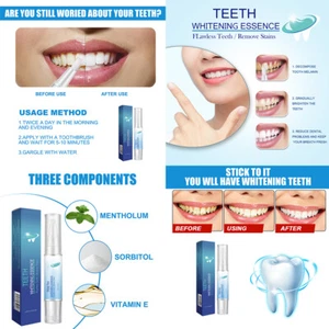 US 1-2 Pack Teeth Whitening Essence Pen Intensive Stain Remover Reduce Yellowing - Picture 1 of 16