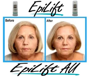 Instant FACELIFT Firming Anti Wrinkle+Ageing Skin SERUM EpiLift FREE P&H - Picture 1 of 10