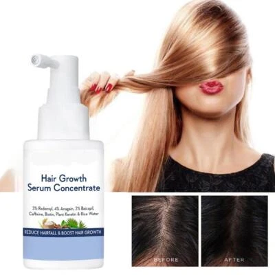 30ml WishCare Hair Growth SerumConcentrate With Plant Keratin & Rice Water UK