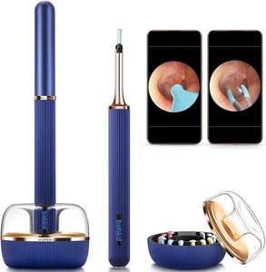 Bebird Note3 Pro 10mp - Hd Ear Wax Removal With Camera And Removal Tool - Picture 1 of 6