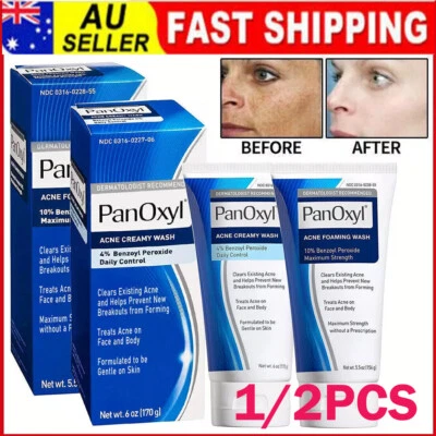 1/2Pcs Acne Foaming Wash, Face & Body, 10% Benzoyl Peroxide - 156g - image 1 of 4