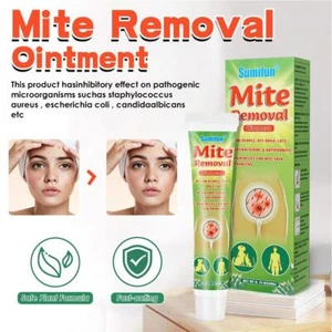 ☮Mite Removal Ointments Anti-Itching Scabies Kill Head Lice Treatment Care Cream - Bild 1 von 8